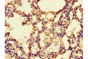 Immunohistochemistry of paraffin-embedded human lung tissue using ABIN7142675 at dilution of 1:100 (PRKAA1 anticorps  (Catalytic Subunit alpha))