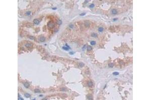 Used in DAB staining on fromalin fixed paraffin- embedded Kidney tissue (FRK anticorps  (AA 234-491))