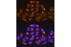 Immunofluorescence analysis of U-2 OS cells using MUT Rabbit pAb (ABIN1680932, ABIN3018357, ABIN3018358 and ABIN6220443) at dilution of 1:100 (40x lens).