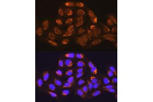 Immunofluorescence analysis of U-2 OS cells using MUT Rabbit pAb (ABIN1680932, ABIN3018357, ABIN3018358 and ABIN6220443) at dilution of 1:100 (40x lens). (MUT anticorps  (AA 451-750))