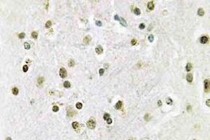 Immunohistochemistry (IHC) analyzes of DGK-theta antibody in paraffin-embedded human brain tissue. (DGKQ anticorps)