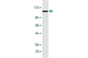 Western Blot detection against Immunogen (144. (UBA1 anticorps  (AA 1-1058))