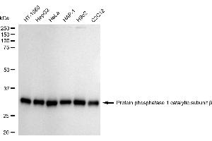Western blotting analysis using Protein phosphatase 1 catalytic subunit beta antibody (ABIN7800017).