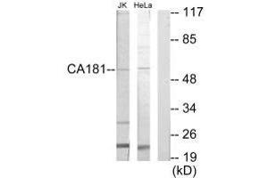 Western blot analysis of extracts from Jurkat cells and HeLa cells, using CA181 antibody.