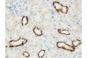 Anti-Aquaporin 3 antibody, IHC(P) IHC(P): Rat Kidney Tissue (AQP3 anticorps  (C-Term))