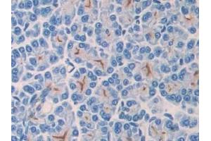 Detection of CD55 in Rat Pancreas Tissue using Polyclonal Antibody to Cluster Of Differentiation 55 (CD55)