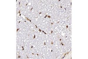 Immunohistochemistry analysis of paraffin embedded rat spinal cord using Neurotensin (ABIN7074827) at dilution of 1: 400