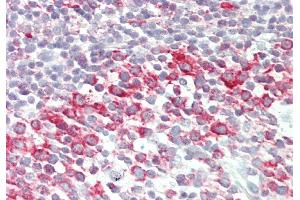 Rabbit Anti-BRD9 antibody  Formalin Fixed Paraffin Embedded Tissue: Human Tonsil Primary antibody Concentration: 1:100 Secondary Antibody: Donkey anti-Rabbit-Cy3 Secondary Antibody Concentration: 1:200 Magnification: 20x Exposure Time: 0.