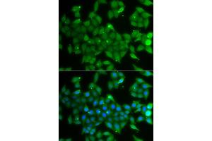 Immunofluorescence analysis of A549 cell using ANXA11 antibody. (Annexin A11 anticorps)