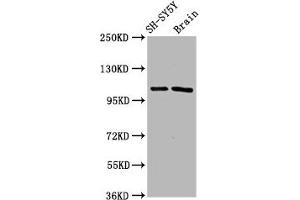 Western Blot Positive WB detected in: SH-SY5Y whole cell lysate, Rat brain tissue All lanes: FBXO10 antibody at 4. (Cyclin F anticorps  (AA 248-400))