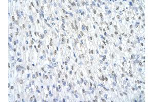 Rabbit Anti-SF3B1 Antibody       Paraffin Embedded Tissue:  Human cardiac cell   Cellular Data:  Epithelial cells of renal tubule  Antibody Concentration:   4.