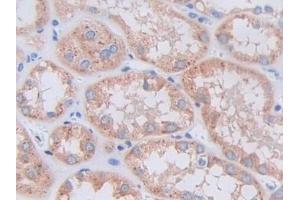Detection of CTSV in Human Kidney Tissue using Polyclonal Antibody to Cathepsin V (CTSV) (Cathepsin L2 anticorps  (AA 64-334))