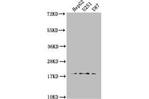 Western Blot Positive WB detected in: HepG2 whole cell lysate, U251 whole cell lysate, U87 whole cell lysate All lanes: ARL2BP antibody at 1:1000 Secondary Goat polyclonal to rabbit IgG at 1/50000 dilution Predicted band size: 19, 18 kDa Observed band size: 19 kDa (ARL2BP anticorps  (AA 1-163))