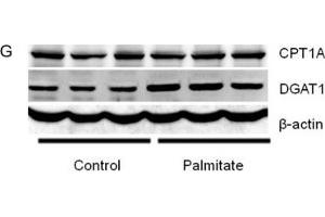 miR-30c-5p expression and triglyceride accumulation in db/db mice(A) Relative expression of miR-30c-5p among different organs.