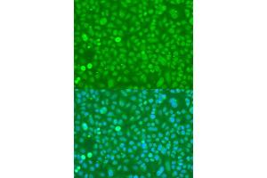 Immunofluorescence analysis of U2OS cells using UBC antibody.