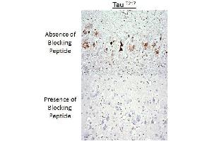 Immunohistochemistry analysis of a competition assay demonstrating the specificity of the anti-Tau (Thr-217) antibody (tau anticorps  (pThr217))