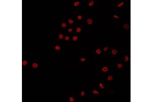ABIN6266681 staining K562 by IF/ICC. (NK6 Homeobox 3 anticorps  (Internal Region))