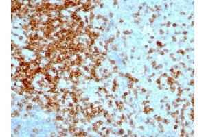 Formalin-fixed, paraffin-embedded human Tonsil stained with CD43 Mouse Monoclonal Antibody (84-3C1). (CD43 anticorps)
