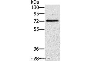 Western blot analysis of Hepg2 cell, using SSX2IP Polyclonal Antibody at dilution of 1:500 (SSX2IP anticorps)