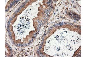 Image no. 9 for anti-Tubulin beta 4a (TUBB4A) antibody (ABIN1501580)