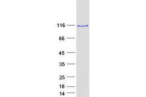 Validation with Western Blot