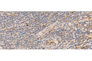 Immunohistochemistry of paraffin-embedded Human tonsil tissue using PDIA5 Polyclonal Antibody at dilution of 1:50(x200)