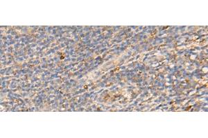 Immunohistochemistry of paraffin-embedded Human tonsil tissue using PDIA5 Polyclonal Antibody at dilution of 1:50(x200) (PDIA5 anticorps)