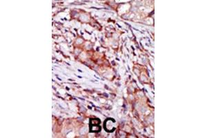 Immunohistochemistry (IHC) image for anti-KIP2 antibody (ABIN3003730) (KIP2 anticorps)