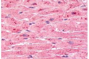 Immunohistochemistry (Formalin/PFA-fixed paraffin-embedded sections) of human heart tissue with ELTD1 polyclonal antibody . (ELTD1 anticorps  (C-Term))