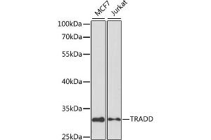 Western blot analysis of extracts of various cell lines, using TRADD antibody (ABIN3021541, ABIN3021542, ABIN3021543 and ABIN6215219) at 1:1000 dilution.