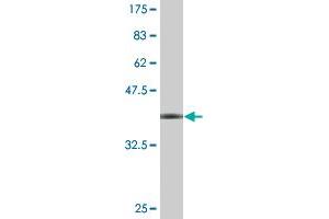 Western Blot detection against Immunogen (36. (WRAP53 anticorps  (AA 62-160))
