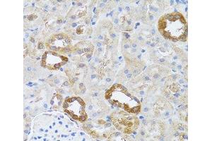 Immunohistochemistry of paraffin-embedded Rat kidney using RNASEL Polyclonal Antibody at dilution of 1:100 (40x lens).