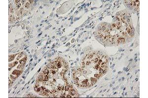 Image no. 1 for anti-Fibroblast Growth Factor 21 (FGF21) antibody (ABIN1498256) (FGF21 anticorps)