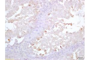 Formalin-fixed and paraffin embedded rat testis labeled with Anti-Acrosin Polyclonal Antibody, Unconjugated (ABIN1387665) at 1:200 followed by conjugation to the secondary antibody and DAB staining (Acrosin anticorps  (AA 201-300))