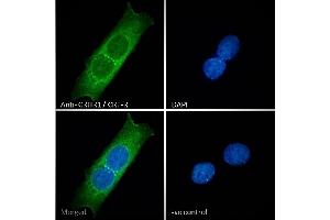 ABIN238557 Immunofluorescence analysis of paraformaldehyde fixed MCF7 cells, permeabilized with 0. (CRHR1 anticorps  (AA 107-117))
