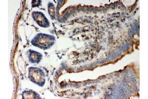 Anti- STIM1 Picoband antibody, IHC(P) IHC(P): Mouse Intestine Tissue