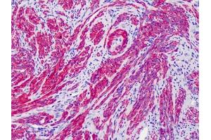 Human Uterus: Formalin-Fixed, Paraffin-Embedded (FFPE)