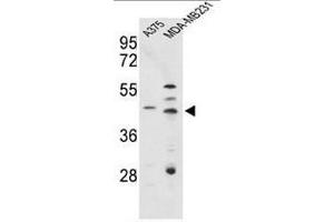 Western blot analysis of CTSD Antibody (C-term) in A375, MDA-MB231 cell line lysates (35µg/lane). (Cathepsin D anticorps  (C-Term))