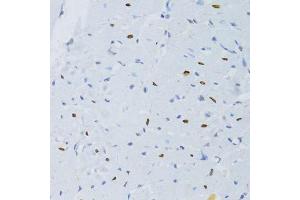 Immunohistochemistry of paraffin-embedded rat heart using SNRNP70 antibody.