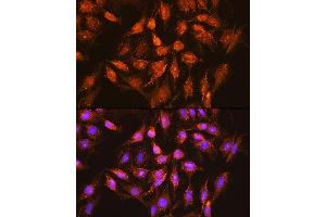 Immunofluorescence analysis of C6 cells using Bcl-XL Rabbit pAb (ABIN3020685, ABIN3020686, ABIN1512625 and ABIN6213668) at dilution of 1:100 (40x lens).
