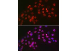 Immunofluorescence analysis of OVCAR-3 cells using WT1 Rabbit pAb (ABIN7271369) at dilution of 1:100 (40x lens). (WT1 anticorps  (AA 1-302))