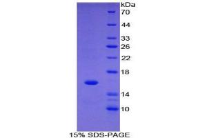 SDS-PAGE of Protein Standard from the Kit (Highly purified E.
