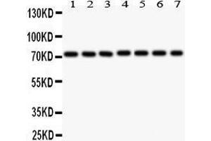 Anti- SDHA Picoband antibody, Western blotting All lanes: Anti SDHA  at 0. (SDHA anticorps  (AA 44-380))