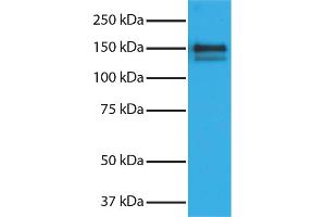 Purified Human Type I Collagen secondary antibody and chemiluminescent detection. (Âne anti-Chévre IgG (Heavy & Light Chain) Anticorps (HRP) - Preadsorbed)