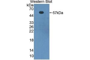 Detection of Recombinant FOXP3, Mouse using Polyclonal Antibody to Forkhead Box P3 (FOXP3)