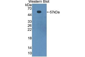Detection of Recombinant FOXP3, Mouse using Polyclonal Antibody to Forkhead Box P3 (FOXP3) (FOXP3 anticorps  (AA 190-412))