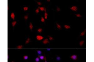 Immunofluorescence analysis of PC-12 cells using FLNB Polyclonal Antibody at dilution of 1:100 (40x lens).