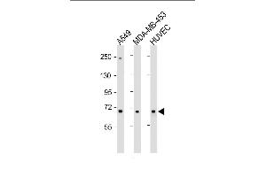 All lanes : Anti-COL8A1 Antibody (N-term) at 1:1000 dilution Lane 1: A549 whole cell lysate Lane 2: MDA-MB-453 whole cell lysate Lane 3: HUVEC whole cell lysate Lysates/proteins at 20 μg per lane.