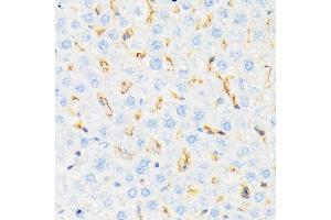 Immunohistochemistry of paraffin-embedded rat liver using CSK Rabbit mAb (ABIN1513217, ABIN3021034, ABIN3021035 and ABIN7101334) at dilution of 1:100 (40x lens).