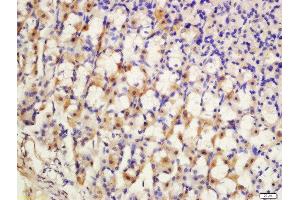 Formalin-fixed and paraffin embedded rat stomach labeled with Anti-SCN7A Polyclonal Antibody, Unconjugated  at 1:200 followed by conjugation to the secondary antibody and DAB staining. (SCN7A anticorps  (AA 1561-1582))